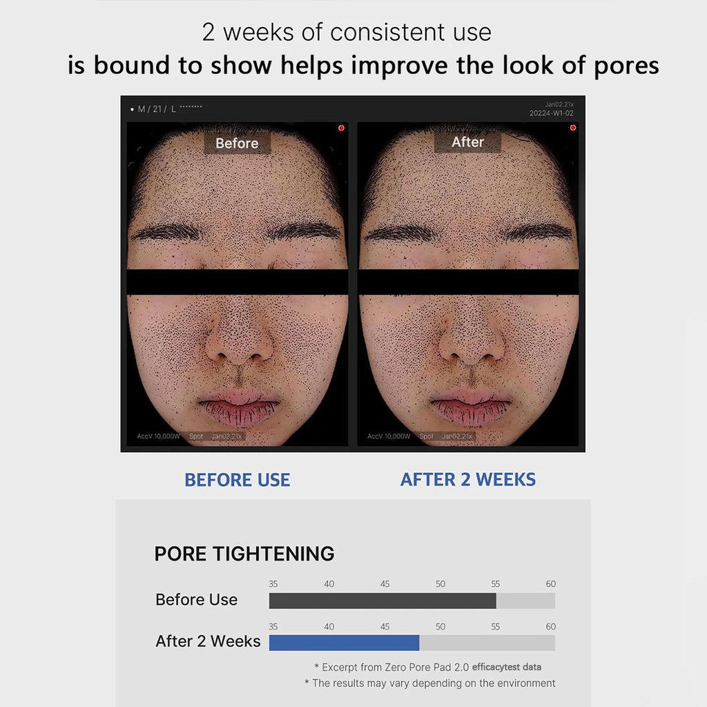 Medicube Zero Pore Pad 2.0 – Coton Bi-Texture Hydratant & Apaisant K-Beauty