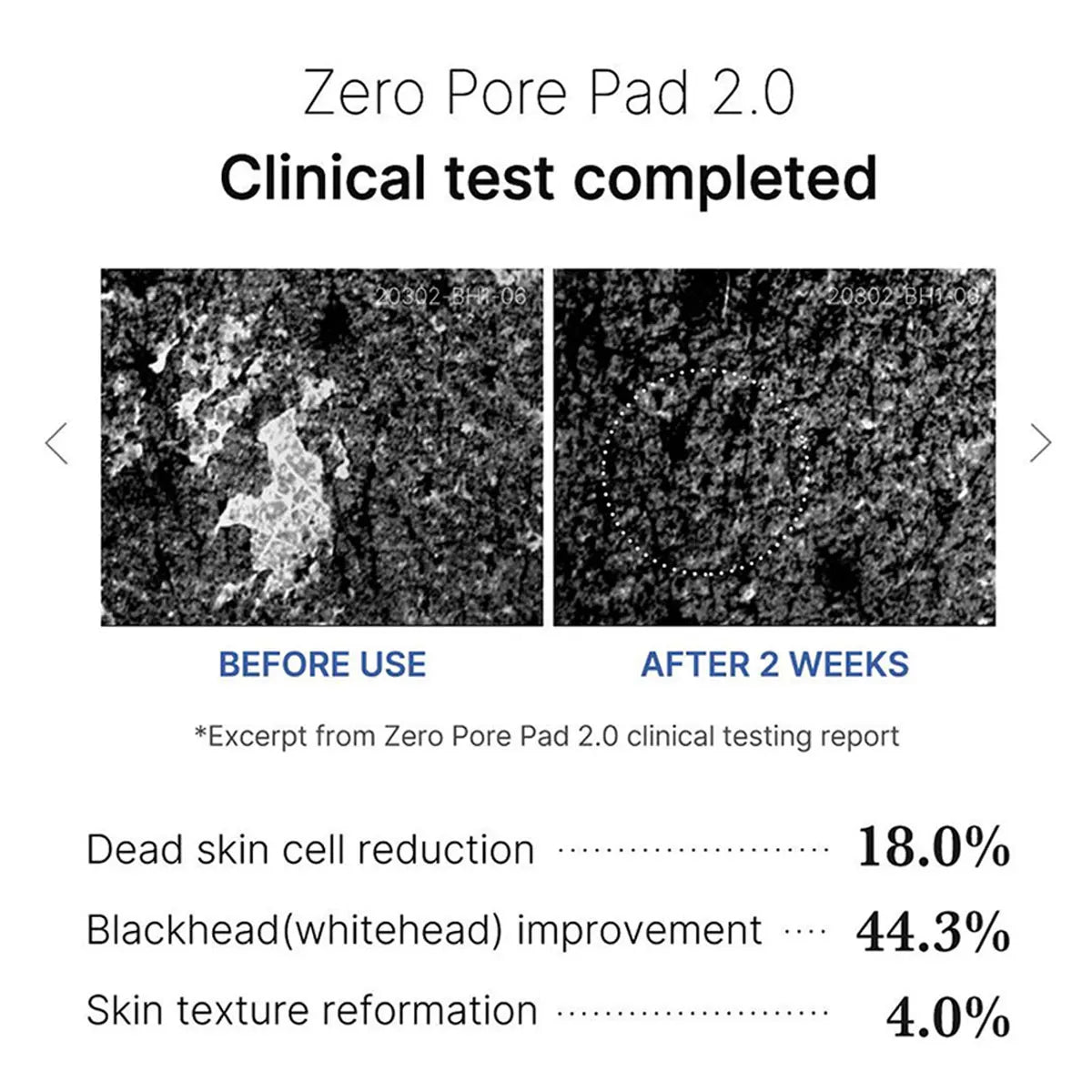 Medicube Zero Pore Pad 2.0 – Coton Bi-Texture Hydratant & Apaisant K-Beauty